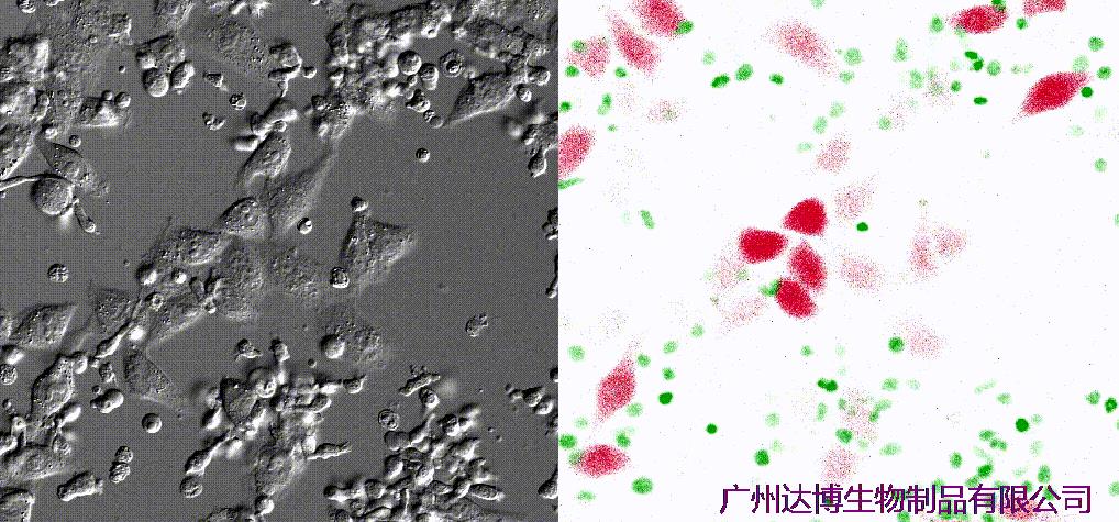 喜訊連連！達(dá)博生物“自體自然殺傷細(xì)胞注射液”獲II期臨床試驗(yàn)?zāi)驹S可